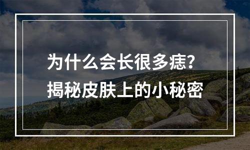 为什么会长很多痣？揭秘皮肤上的小秘密