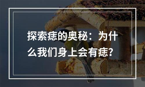探索痣的奥秘：为什么我们身上会有痣？