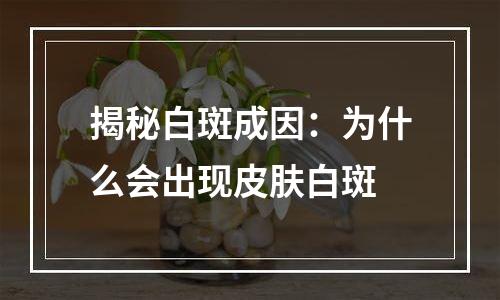揭秘白斑成因：为什么会出现皮肤白斑