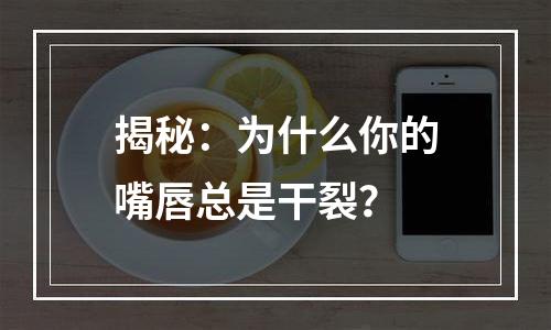揭秘：为什么你的嘴唇总是干裂？