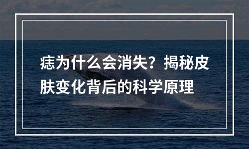 痣为什么会消失？揭秘皮肤变化背后的科学原理