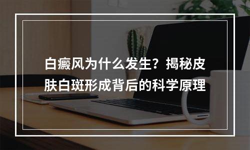 白癜风为什么发生？揭秘皮肤白斑形成背后的科学原理