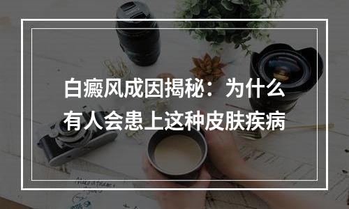 白癜风成因揭秘：为什么有人会患上这种皮肤疾病