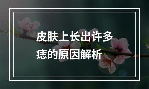 皮肤上长出许多痣的原因解析