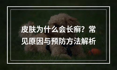 皮肤为什么会长癣？常见原因与预防方法解析