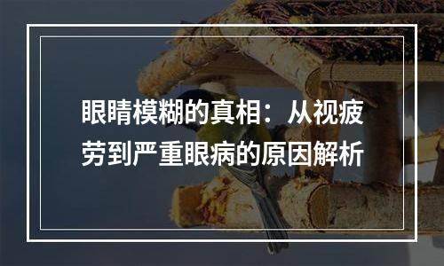 眼睛模糊的真相：从视疲劳到严重眼病的原因解析