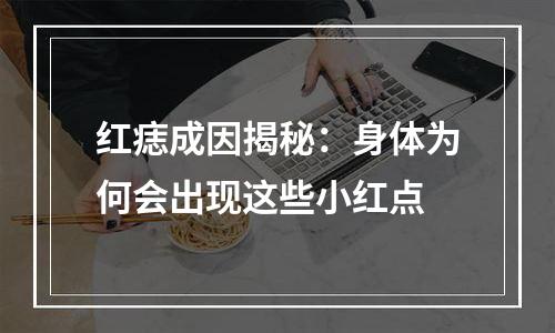 红痣成因揭秘：身体为何会出现这些小红点