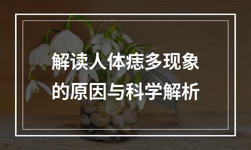 解读人体痣多现象的原因与科学解析