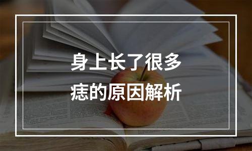 身上长了很多痣的原因解析