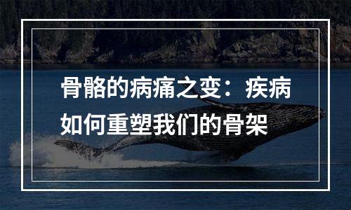 骨骼的病痛之变：疾病如何重塑我们的骨架