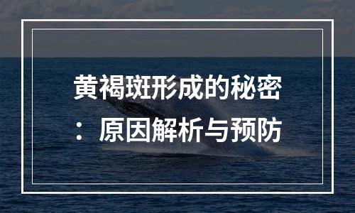黄褐斑形成的秘密：原因解析与预防